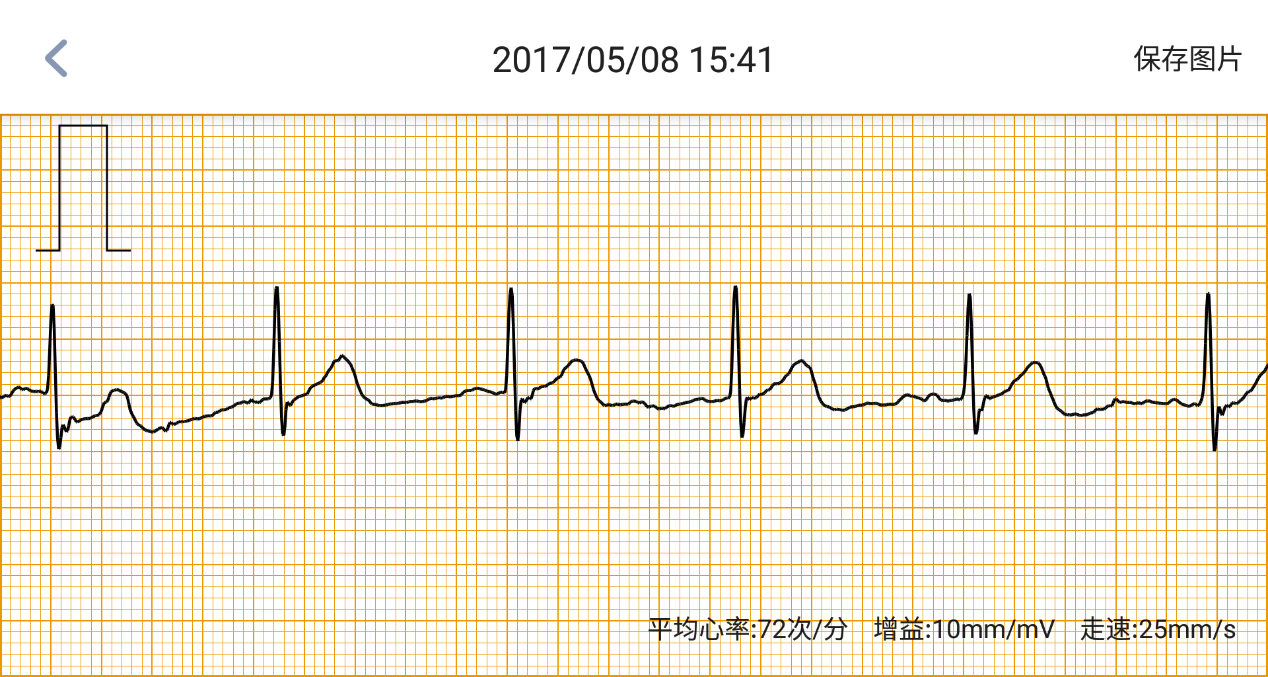 母亲节送啥？米动健康手环超值      